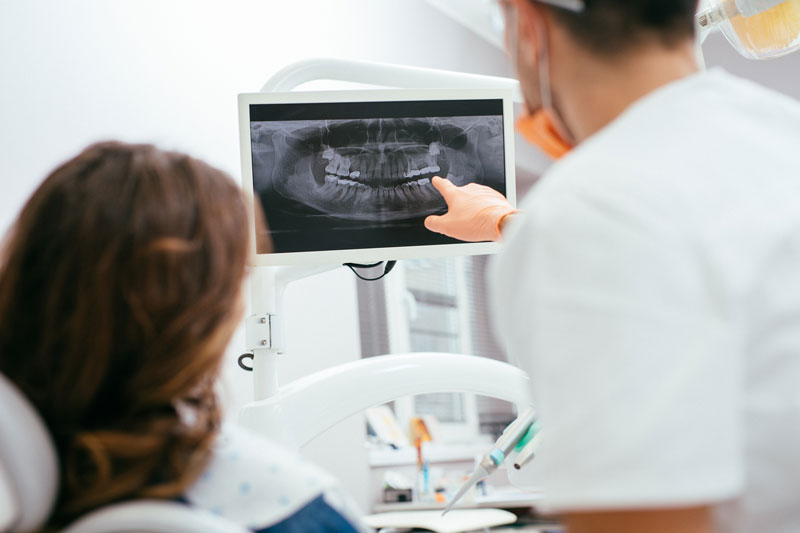 Digital Dental X-Rays in Encino
